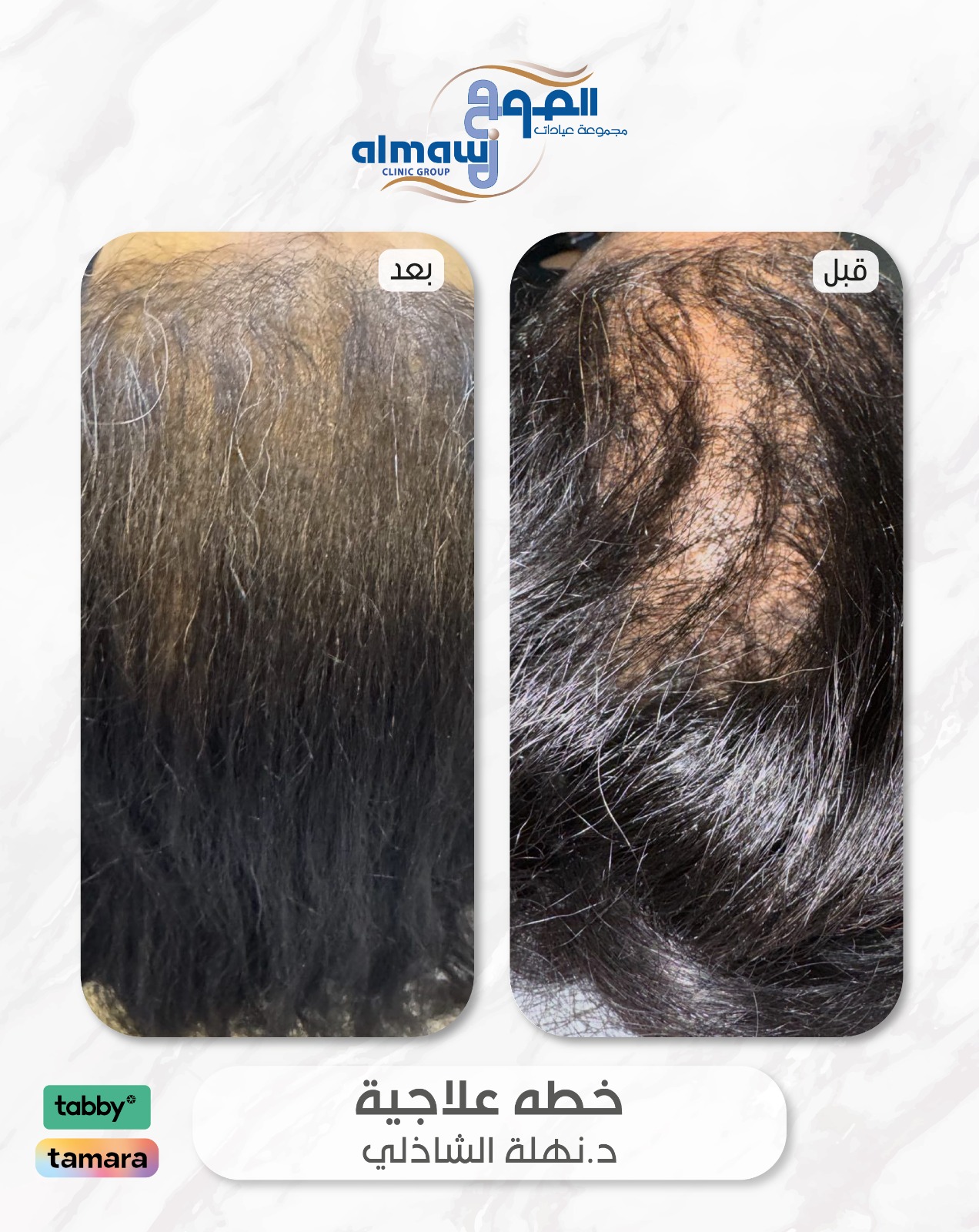 د نهلة فرع الصفا