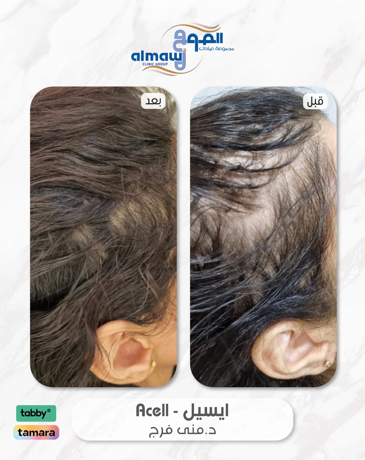 ايسل د منى فرج عيادات الموج فرع الصفا