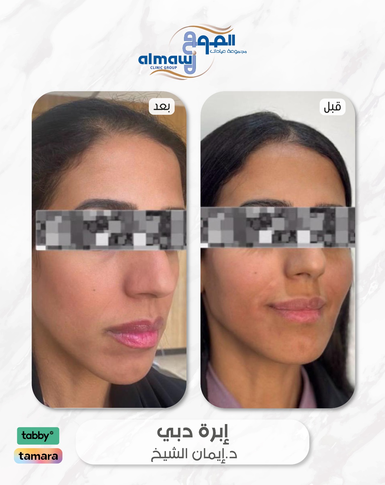 ابرة دبي د ايمان الشيخ عيادات الموج فرع النهضة 